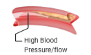 high blood pressure/flow icon