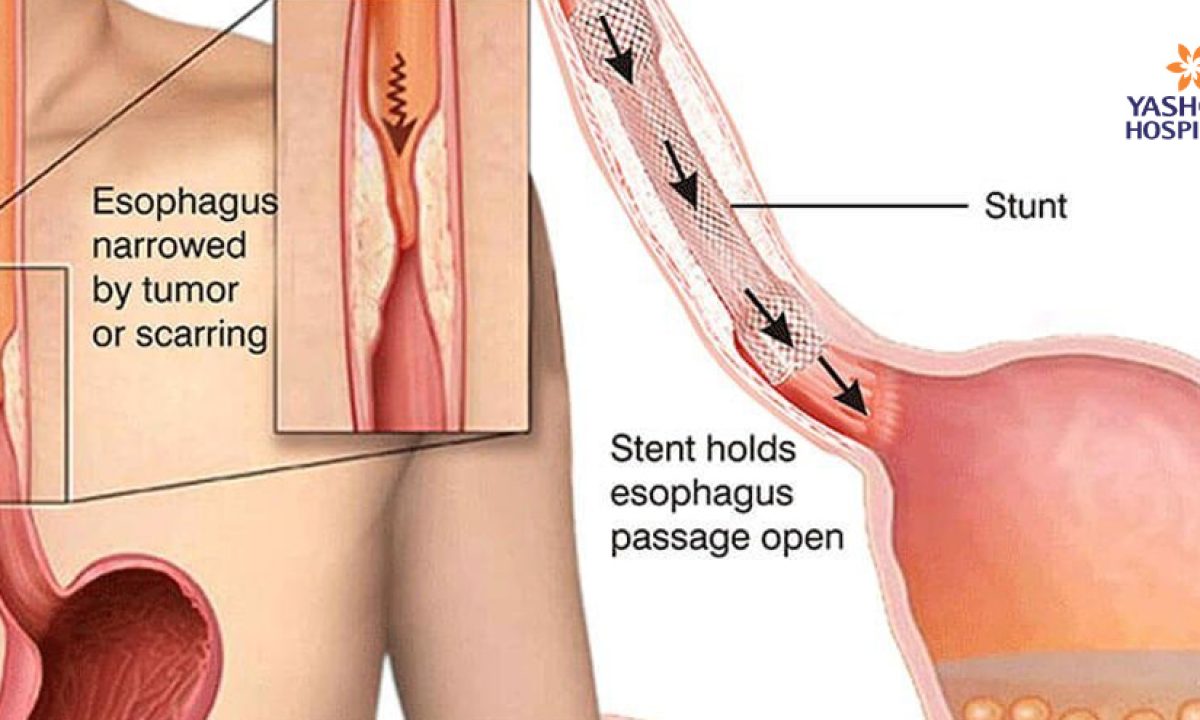 Bu abser edi qadar eshak becerdin