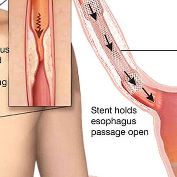 Shisha orqasidagi shouning yalangoch ishtirokchisi