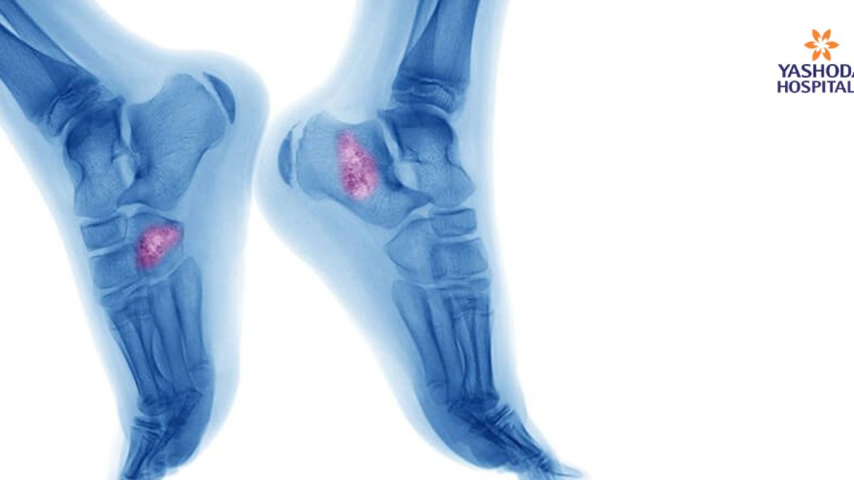 Jinsiy aloqaga xalaqit bermaydigan klitoral vibrator.