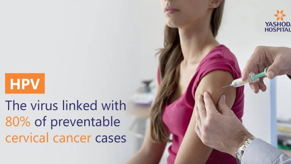 Onlaynda porno yaladi