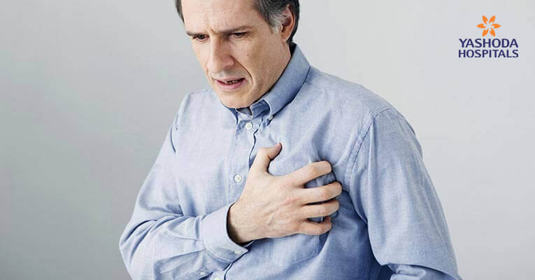 Trans-femoral-brachial approach for the percutaneous angioplasty of eccentric stenosis