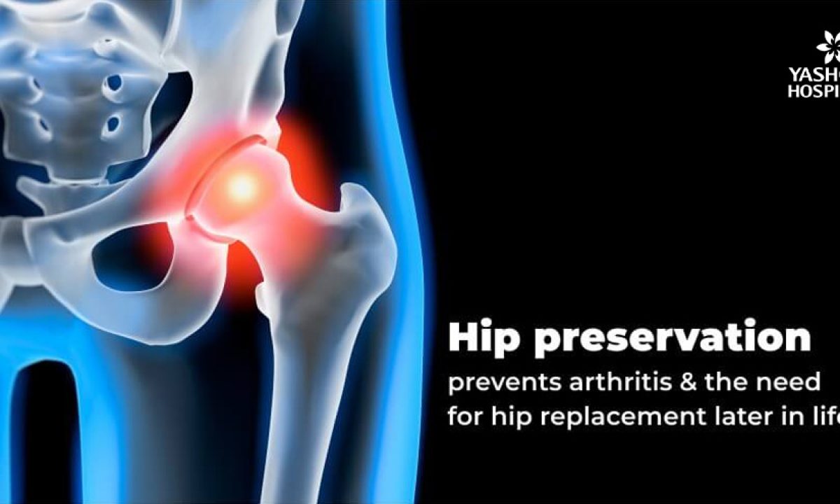 Techniques of hip joint preservation - Yashoda Hospital