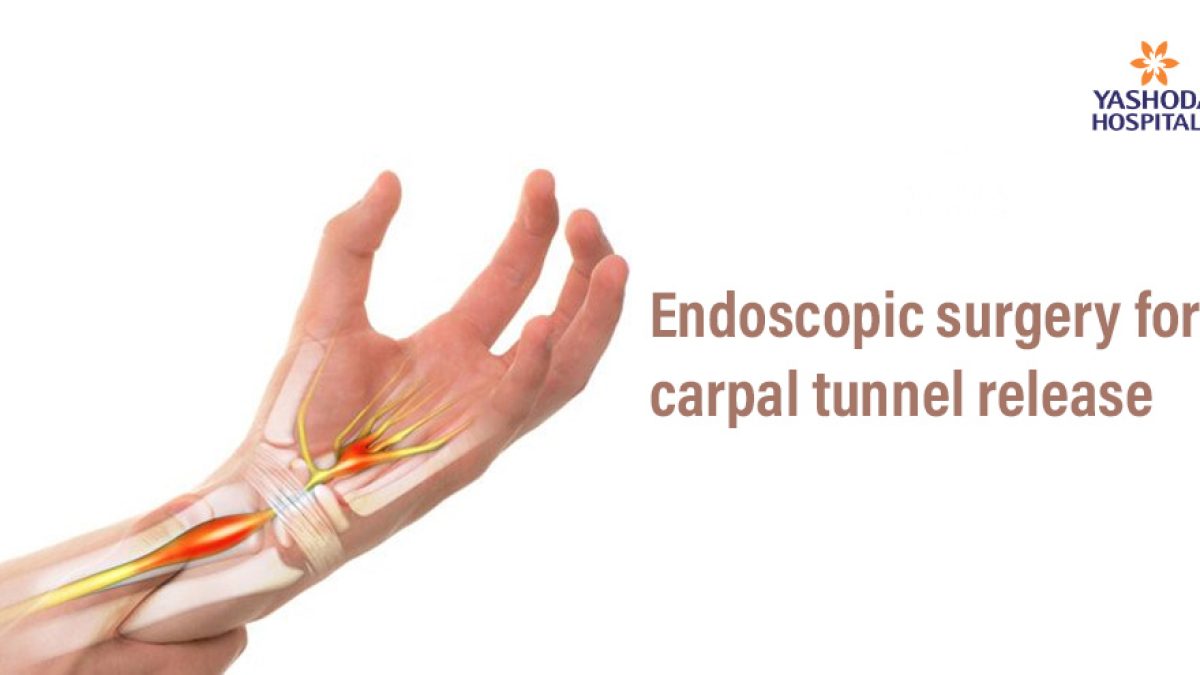carpal-tunnel-syndrome-surgery-endoscopic