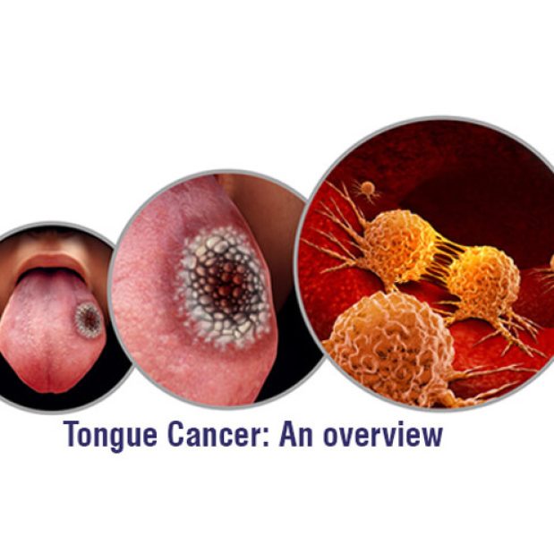 Juda yomon hidli vaginalarning fotosuratlari