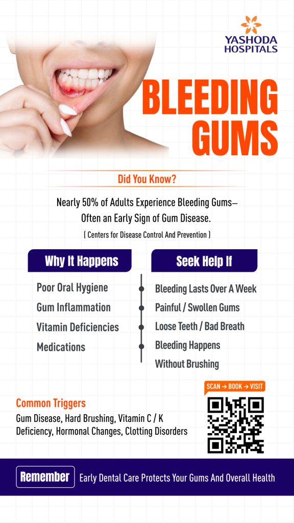 bleeding-gums