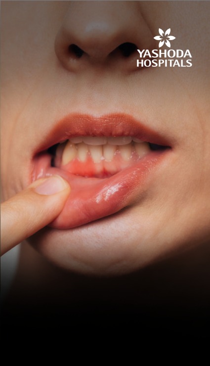 Body Talk: Understanding Your Nutritional Deficiencies