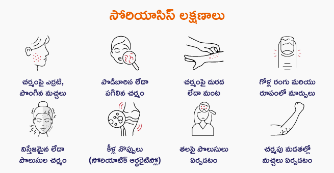PSORIASIS TELUGU symptoms