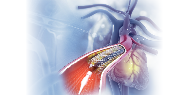 Web Banner_Digital Subtraction Angiography