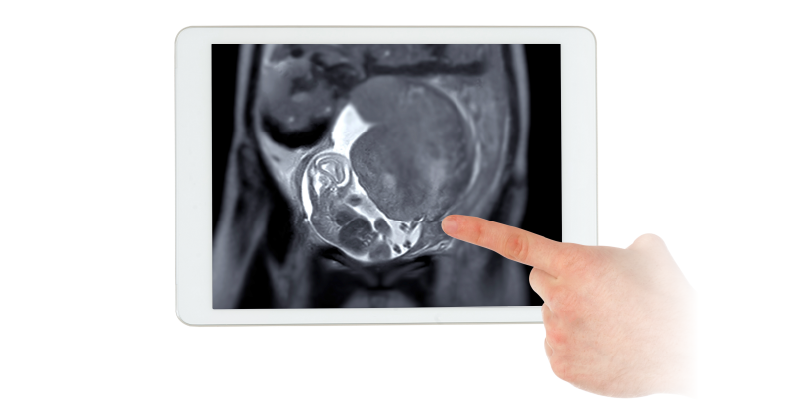 Web Banner_Fetal Neurosonography