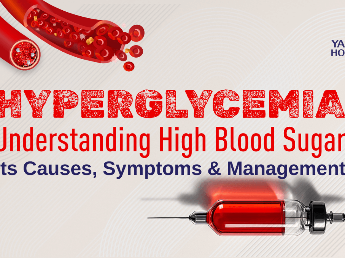 Juda nozik jinsiy aloqa