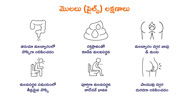 Piles Symtoms
