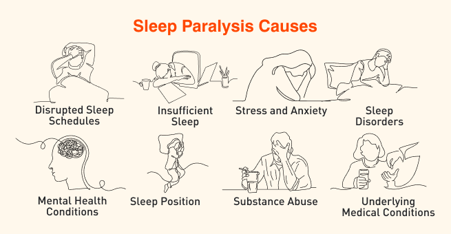 Sleep paralysis Causes