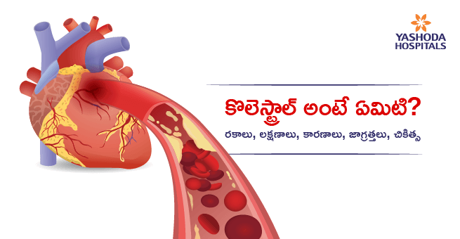 cholesterol Main Banner