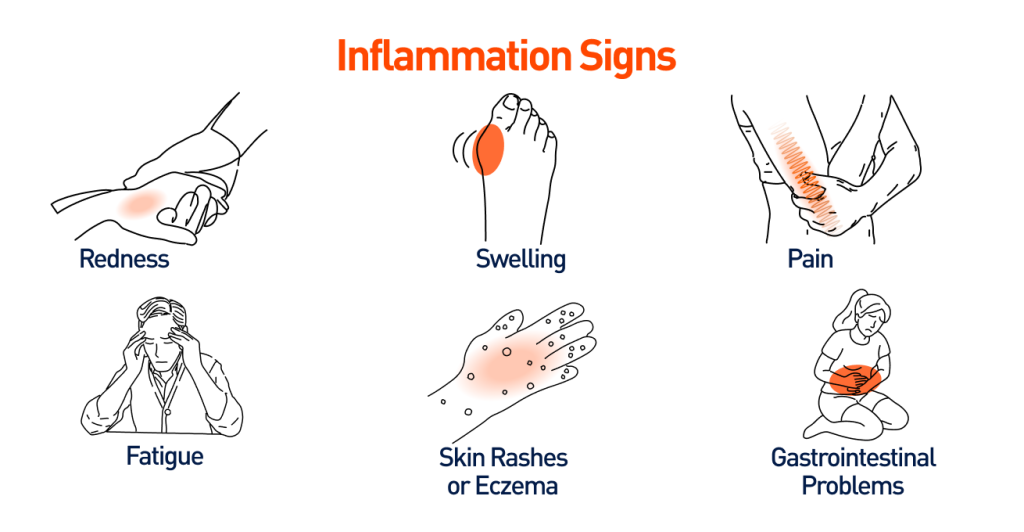 Why Excessive Gym Can Be a Reason for Health Problems, A Functional Medicine Perspective