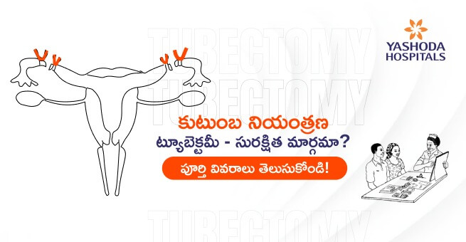 Tubectomy Main telugu banner