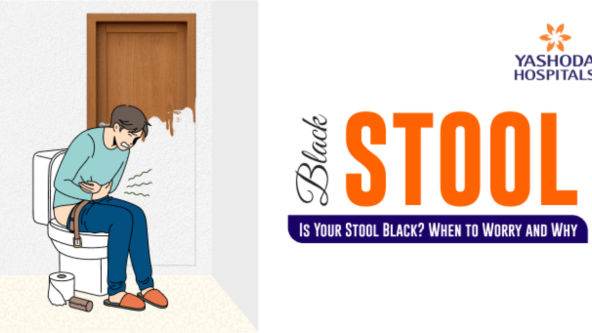 Mushuk ustidagi sexy külotlar