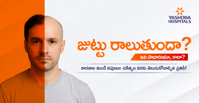 Hair fall Main Banner