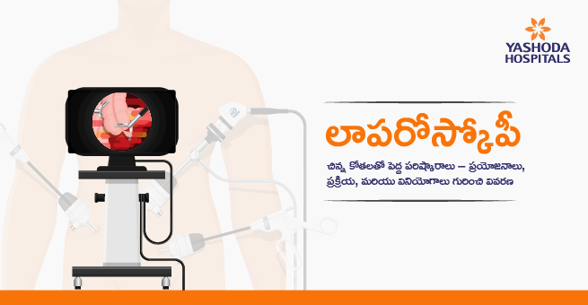 Laparoscopy Telugu Main Banner