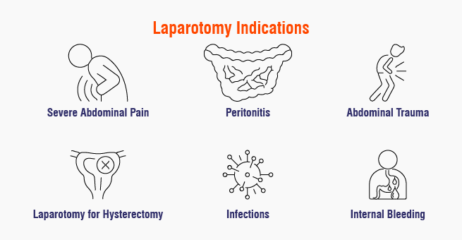Laparotomy_Body