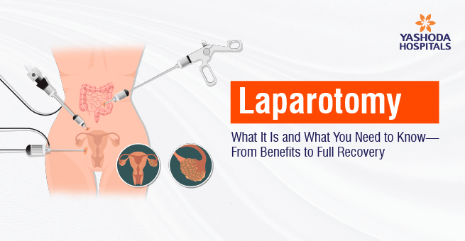 Laparotomy Main Banner