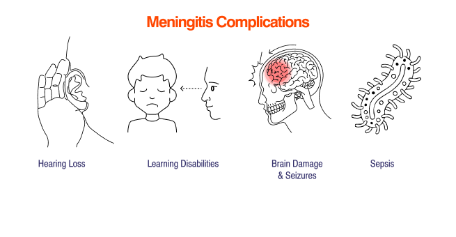 Meningitis Complications