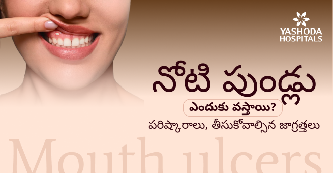 నోటి పుండ్లు: ఎందుకు వస్తాయి? పరిష్కారాలు, తీసుకోవాల్సిన జాగ్రత్తలు
