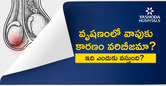 Swelling in the testicle Main Blog