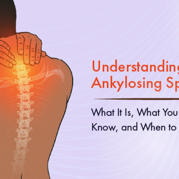 Kamo Sutra jinsiy pozitsiyalari