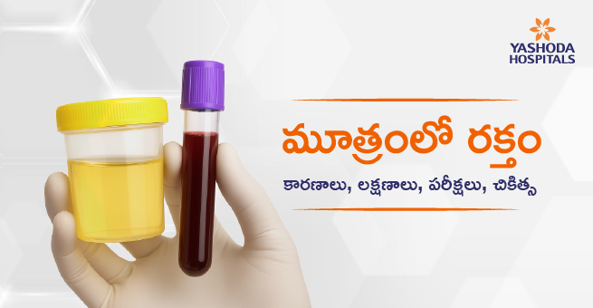 blood-in-urine-telugu-main