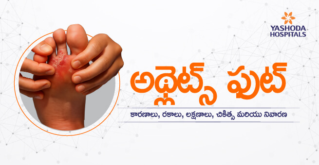 Athlet foot Main Banner