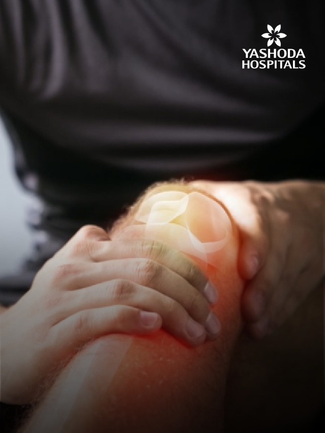 Common Causes of Bone Fractures (It’s Not Just Accidents!)