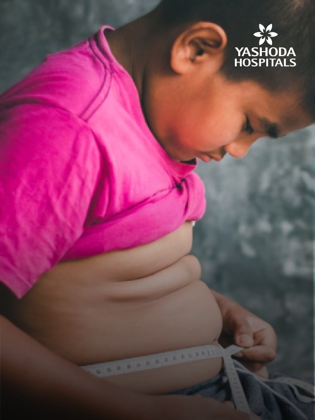 7 Early Signs of Childhood Obesity Every Parent Must Watch Out For!