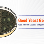 Good Yeast Gone Bad! Main Banner