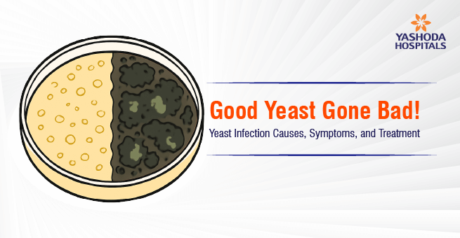 Good Yeast Gone Bad! Main Banner