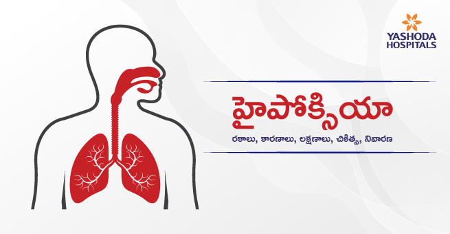 హైపోక్సియా: రకాలు, కారణాలు, లక్షణాలు, చికిత్స, నివారణ