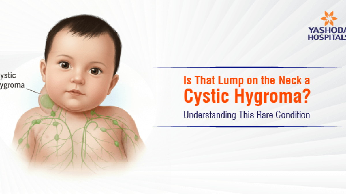 Anal fistingdan keyin muammolar