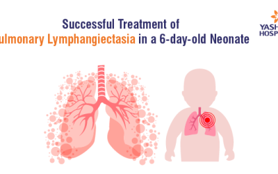 Successful Treatment of Pulmonary Lymphangiectasia in a 6-day-old Neonate