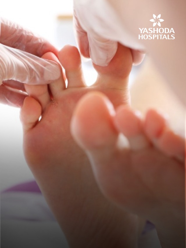 What are 5 Diseases Caused by Fungi