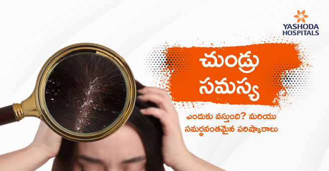 Dandruff problem Telugu Main Banner