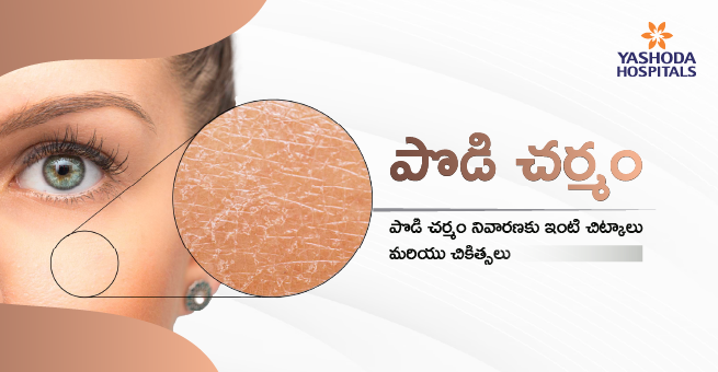 పొడి చర్మం నివారణకు ఇంటి చిట్కాలు మరియు చికిత్సలు