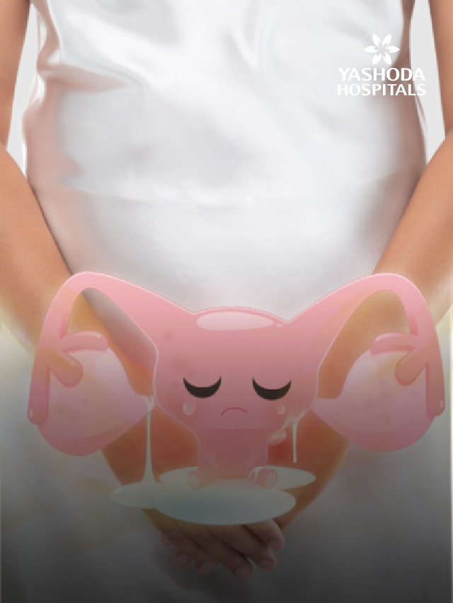 Don’t Ignore These Early Warning Signs of Ovarian Cancer!