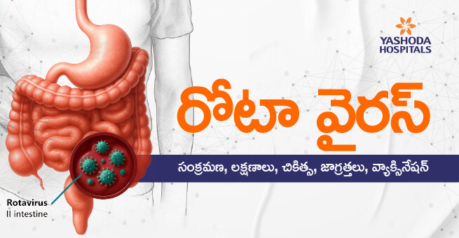 రోటా వైరస్ : సంక్రమణ, లక్షణాలు, చికిత్స, జాగ్రత్తలు, వ్యాక్సినేషన్