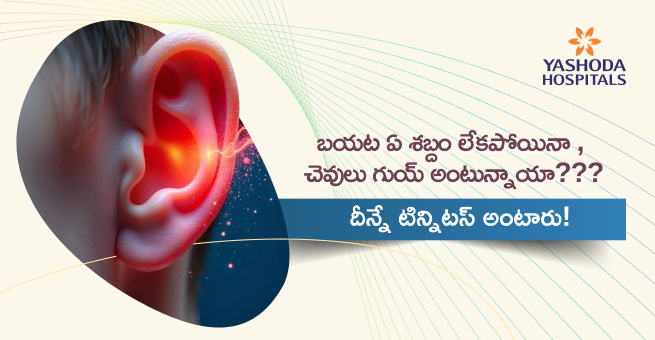 బయట నుండి ఏ శబ్దాలు లేకపోయినా అదేపనిగా చెవులలో హోరుమంటుందా? : ఇదే టిన్నిటస్