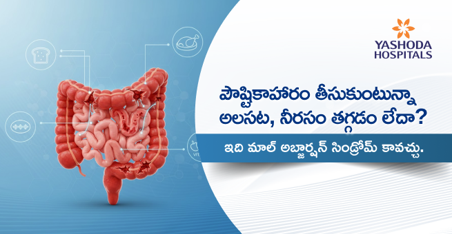 malabsorption-syndrome