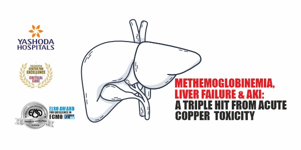 methemoglobinemia-liver-failure-aki-triple-hit-from-acute-copper-toxicity