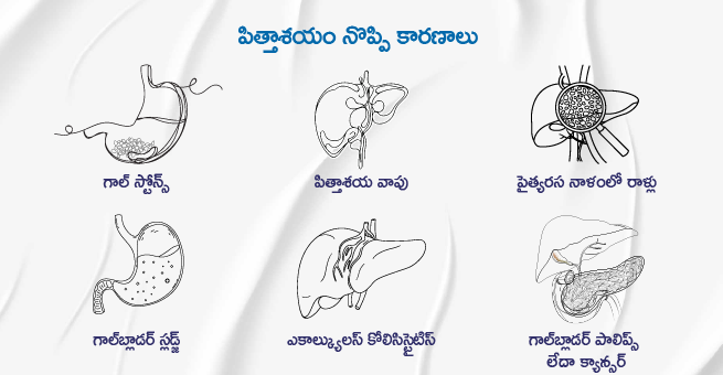 gallbladder- 2