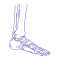 Ankle Replacement