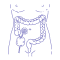Colostomy