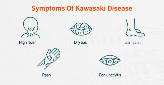 kawasaki-disease